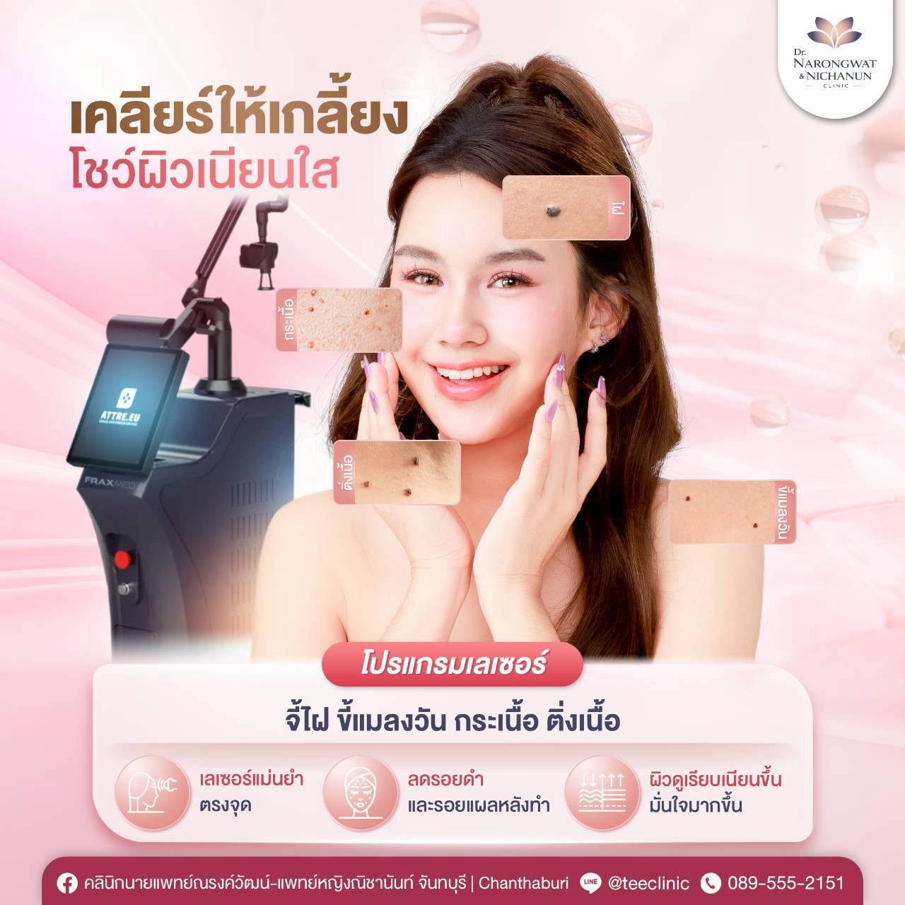LINE_ALBUM_EndoLift_260717_1